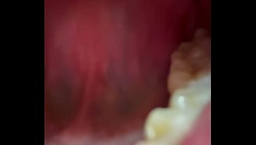 Inside the mouth