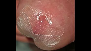 X Foreskin Tape Full Glans Exposure - Transparent Sticker Keeps Cock Head Always Naked