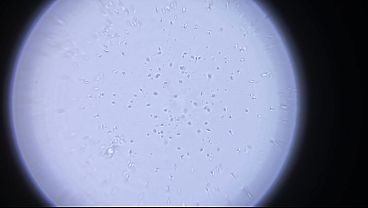 Look at My Fresh Sperm Swimming Under Microscope - For Girls Who Want It