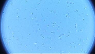 Fresh Cum Under Microscope! My Sperm Swimming Wildly - Super Clear View
